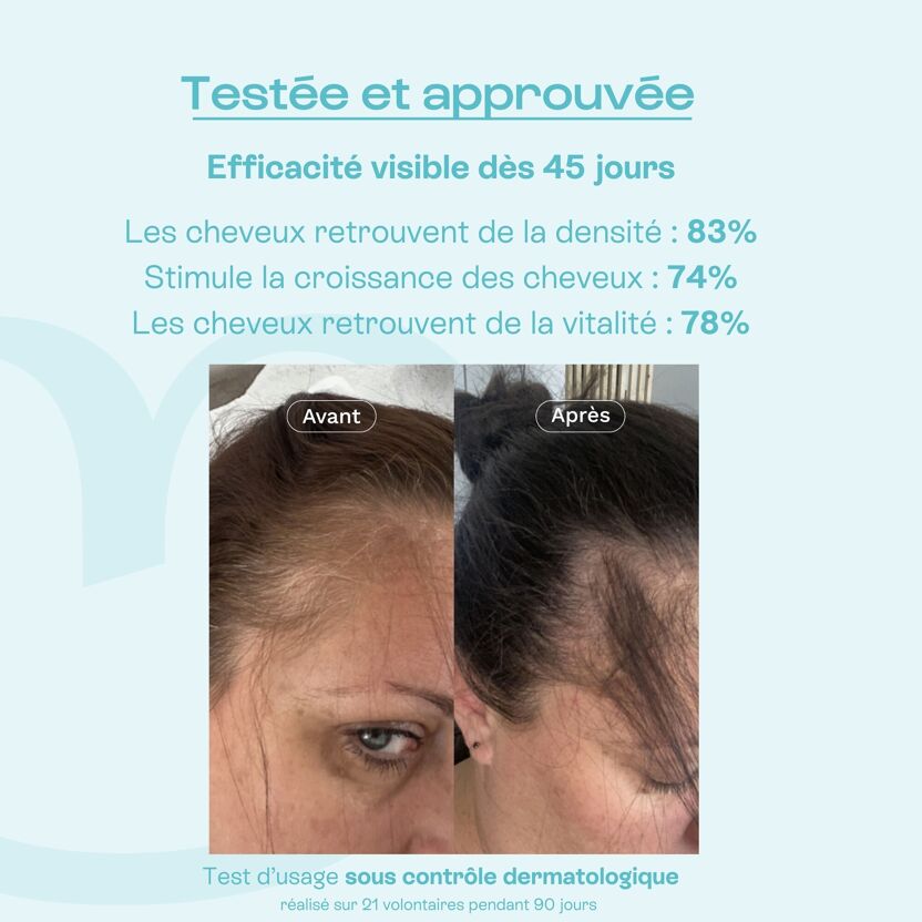 Visuel test d'efficacité d'une lotion capillaire Omum avec résultats et photos avant après