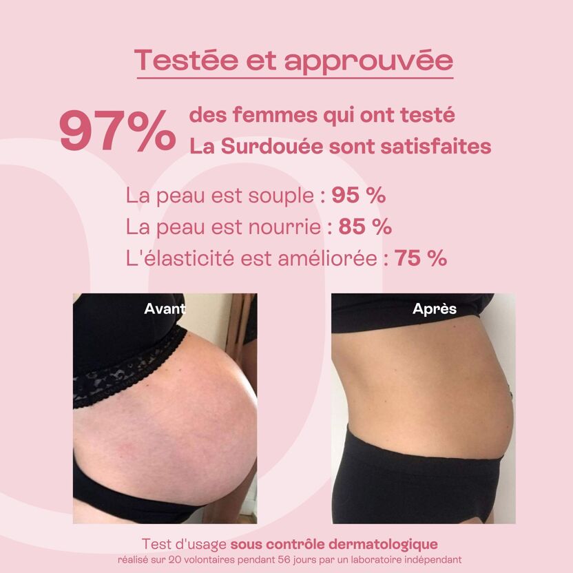 Résultats des tests cliniques de l'huile pour le corps anti vergetures, La Surdouée d'Omum avec visuels d'un ventre de femme enceinte pendant la grossesse et après